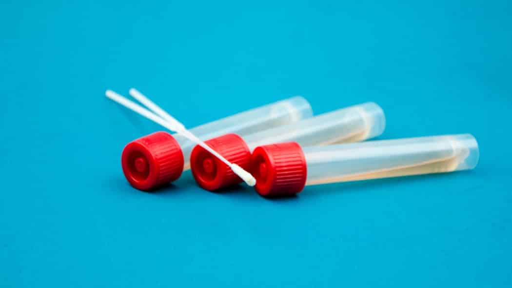 Coronavirus in Marocco: acquisto strategico di 100.000 tamponi per combattere il Covid-19